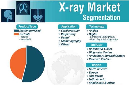 X-Ray Market Segmentation